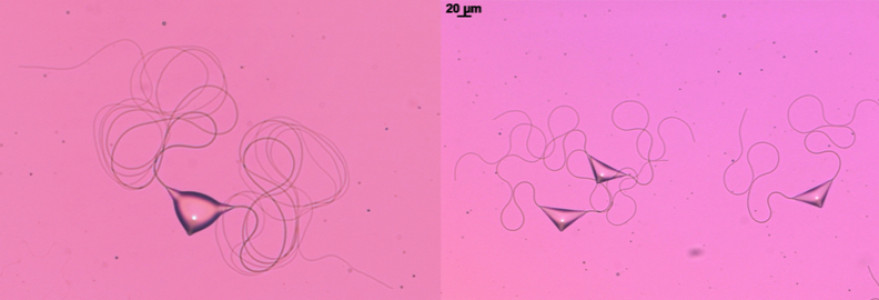 Podczas chłodzenia, kropelki oleju w wodnym roztworze środka powierzchniowo czynnego mogą tworzyć dwa włókna, podobne do wici bakterii, wytwarzane przez wytłaczanie materiału z wnętrza kropelki. Przed wytwarzaniem włókien kropelki przybierają wielokątne kształty z powodu zamarzania środka powierzchniowo czynnego przy powierzchni kropelek. Początkowo proste włókno ulega podczas wzrostu niestabilności wyboczeniowej, a jego ostateczny kształt wynika ze współzawodnictwa jego elastyczności i hydrodynamicznego oporu płynu. Źródło: D. Cholakova, Uniwersytet Sofijski.