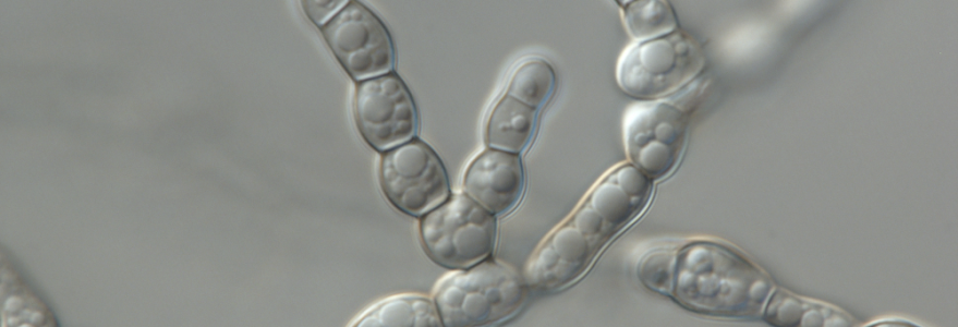 Grzyb Formicomyces microglobosus. Fot. M. Piątek, I. Siedlecki