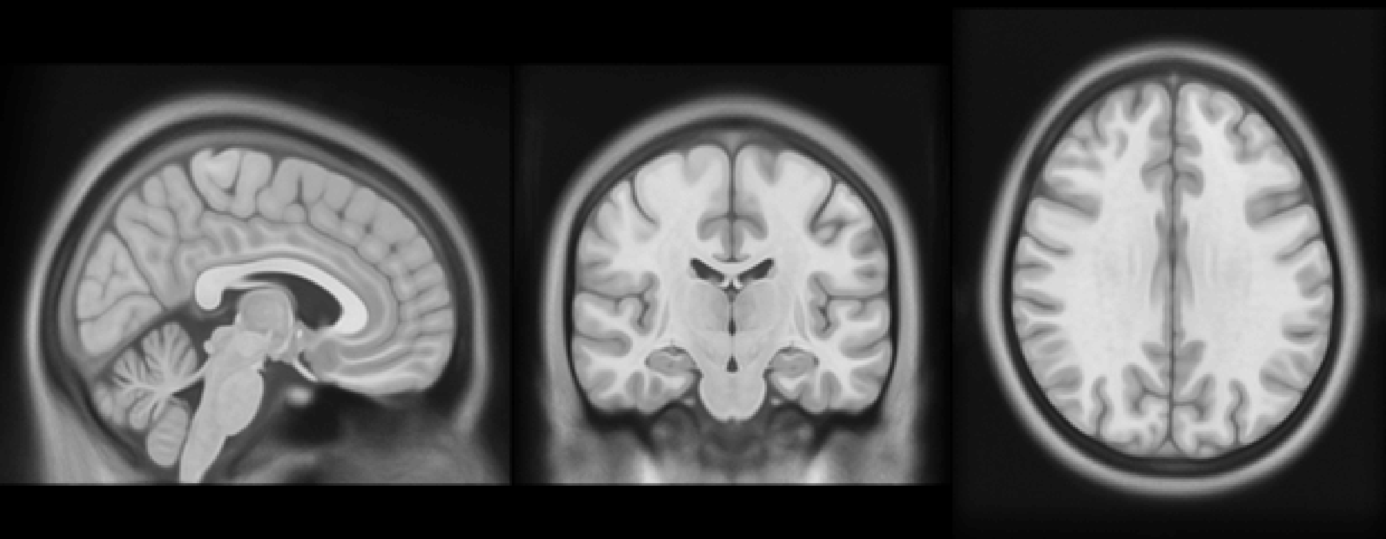 Międzynarodowe badania nad snem